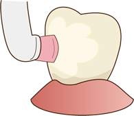 2.歯の表面を磨きます。