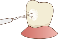 3.研磨剤の洗浄します。