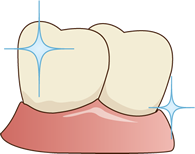 4.フッ素を塗布して終了です。
