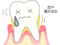 [進行度4] 硬いものが食べられなくなる