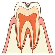 C1