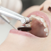 SOT(サポーティブオーラルセラピー)