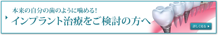 インプラント治療をご検討の方へ
